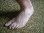<img150*0:stuff/z/169023/Feet41/i1258664838_33.jpg>