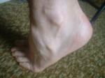 <img150*0:stuff/z/169023/Feet41/i1258664838_34.jpg>