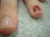 <img100*0:stuff/z/169023/Fingers/i1259710487_12.jpg>
