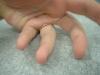 <img100*0:stuff/z/169023/Fingers/i1259710487_13.jpg>