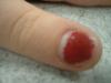 <img100*0:stuff/z/169023/Fingers/i1259710487_14.jpg>