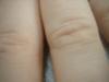 <img100*0:stuff/z/169023/Fingers/i1259710487_18.jpg>