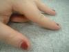 <img100*0:stuff/z/169023/Fingers/i1259710487_3.jpg>