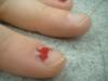 <img100*0:stuff/z/169023/Fingers/i1259710487_8.jpg>