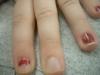 <img100*0:stuff/z/169023/Fingers/i1259710488_24.jpg>