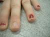 <img100*0:stuff/z/169023/Fingers/i1259710488_30.jpg>