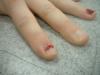 <img100*0:stuff/z/169023/Fingers/i1259710488_36.jpg>