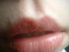 <img100*0:stuff/z/169023/Lips%252041/i1259707194_22.jpg>