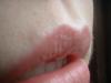 <img100*0:stuff/z/169023/Lips%252041/i1259707195_38.jpg>