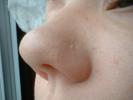 Nose Stock
