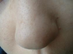 <img250*0:stuff/z/169023/Nose%2520Stock/i1256079647_15.jpg>