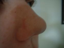 <img250*0:stuff/z/169023/Nose%2520Stock/i1256079647_2.jpg>