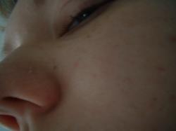 <img250*0:stuff/z/169023/Nose%2520Stock/i1256079647_22.jpg>