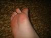 <img100*0:stuff/z/169023/Toes%252018/i1259627002_2.jpg>