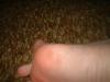 <img100*0:stuff/z/169023/Toes%252018/i1259627002_5.jpg>