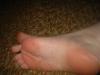 <img100*0:stuff/z/169023/Toes%252018/i1259627002_9.jpg>