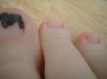 <img150*0:stuff/z/169023/Toes/i1258575900_16.jpg>