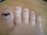<img150*0:stuff/z/169023/Toes/i1258575900_8.jpg>