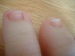 <img150*0:stuff/z/169023/Toes/i1258575901_19.jpg>
