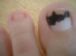 <img150*0:stuff/z/169023/Toes/i1258575901_20.jpg>