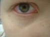 <img100*0:stuff/z/169023/eyes%252018/i1259706680_2.jpg>