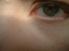 <img100*0:stuff/z/169023/eyes%252018/i1259706680_3.jpg>