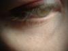 <img100*0:stuff/z/169023/eyes%252018/i1259706681_14.jpg>