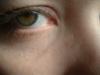 <img100*0:stuff/z/169023/eyes%252018/i1259706681_16.jpg>
