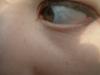 <img100*0:stuff/z/169023/eyes%252018/i1259706681_17.jpg>