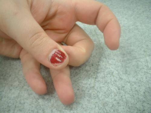 <img500*0:http://elftown.heddate.com/stuff/z/169023/fingers1/i1259710439_2.jpg>