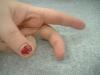 <img100*0:stuff/z/169023/fingers1/i1259710439_5.jpg>