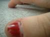 <img100*0:stuff/z/169023/fingers1/i1259710439_6.jpg>