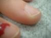 <img100*0:stuff/z/169023/fingers1/i1259710440_15.jpg>