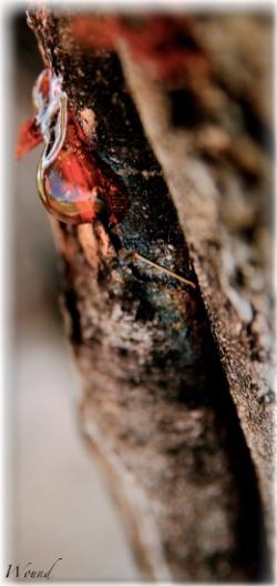 <img250*0:stuff/z/186101/Weet-weet%2520Portfolio%25202/wound.jpg>