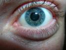 Eye Photo Reference