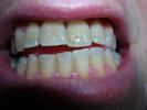 Teeth Photo Reference