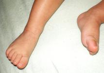 <img0*150:stuff/z/61513/bbft/IMGP4091.JPG>