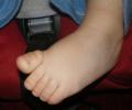 EPRM Jitter Feet