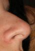 <img0*100:stuff/z/61513/jitternose/Jitternose%20(1).JPG>