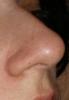 <img0*100:stuff/z/61513/jitternose/Jitternose%20(3).JPG>