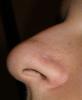 <img0*100:stuff/z/61513/jitternose/Jitternose%20(4).JPG>